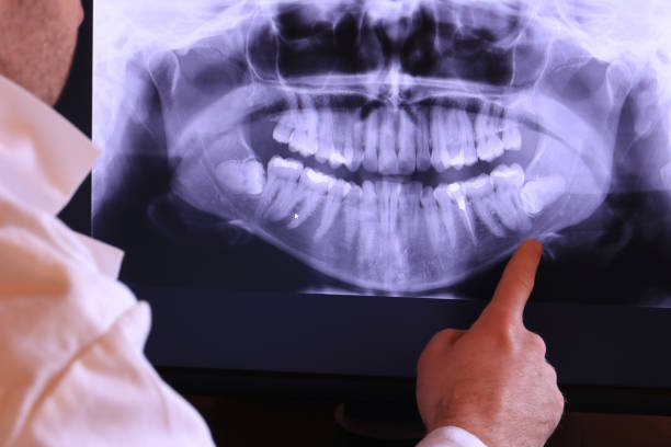 Best Emergency Tooth Extraction in Wright Patterson Af, OH