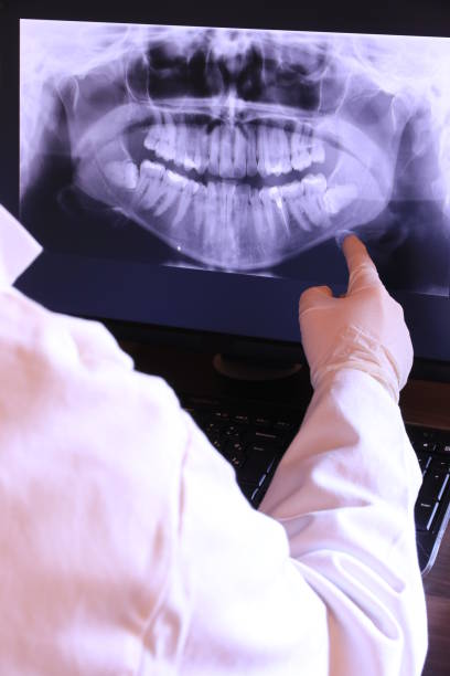 Best Emergency Tooth Extraction in Wright Patterson Af, OH