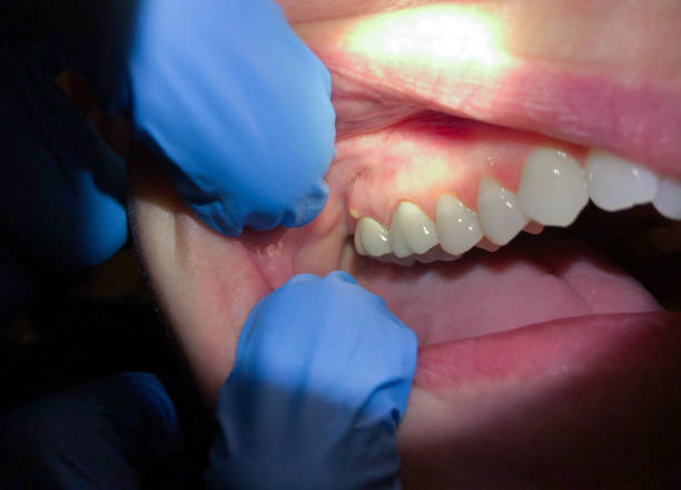 Best Emergency TMJ Treatment in Wright Patterson Af, OH