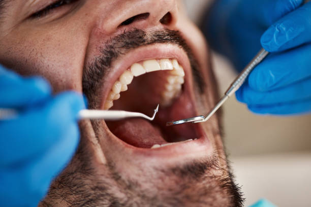 Best Emergency Treatment for Dental Infections or Abscesses in Wright Patterson Af, OH