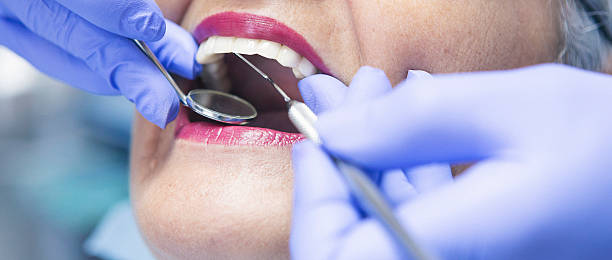 Best Emergency Gum Treatment in Wright Patterson Af, OH